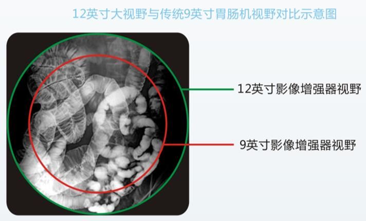 全數(shù)字胃腸機(jī)