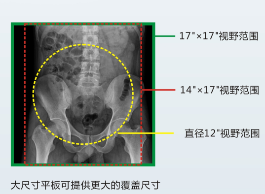 超大視野的x線數(shù)字胃腸機(jī)
